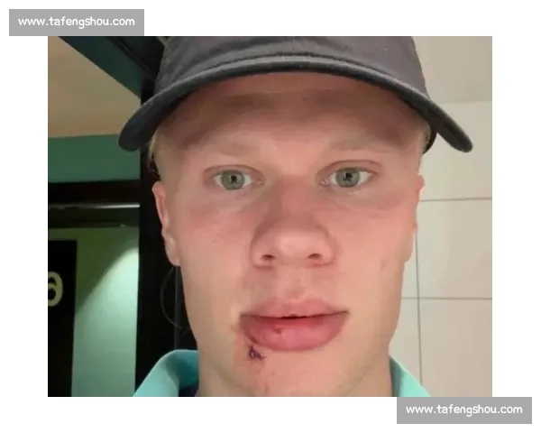 哈兰德警示挪威同胞：迈阿密烈日下的防晒必修课